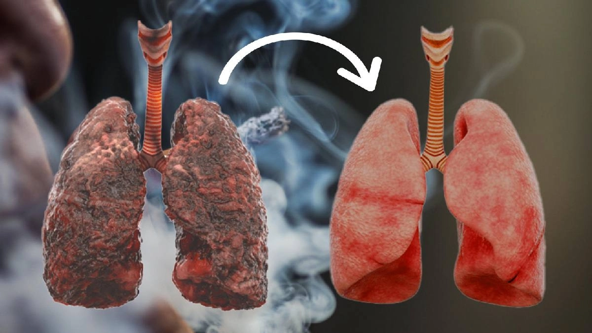 How to take care of your lungs after you quit smoking