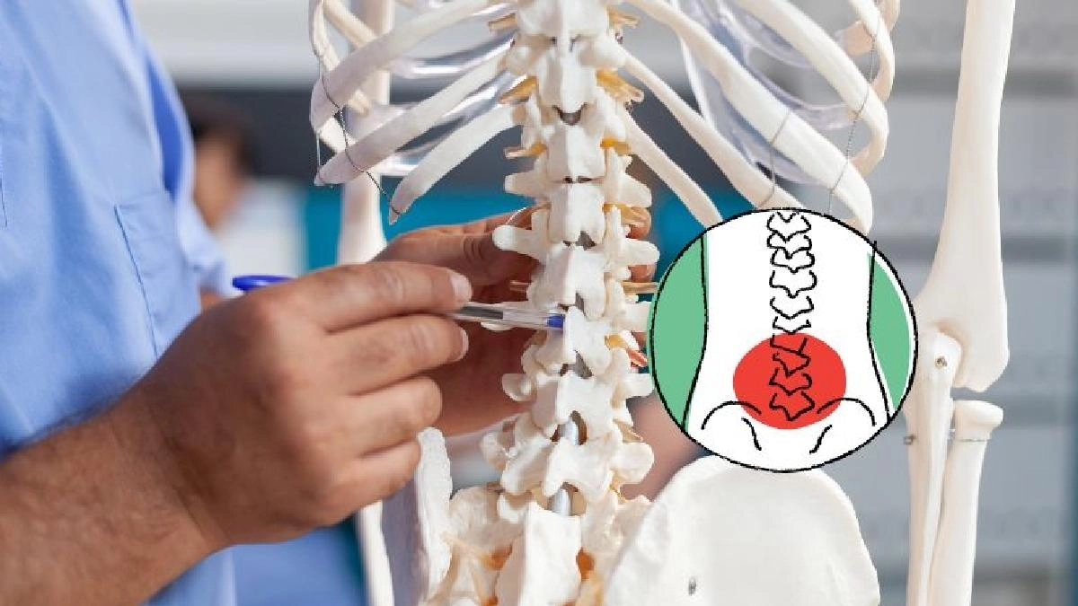 Symptoms and treatment of Spinal Tuberculosis disease